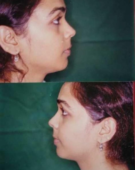 correctjaw shah4